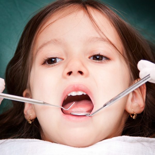 child patient at the dentist - close up